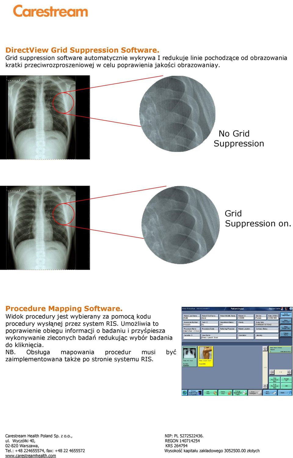 jakości obrazowaniay. No Grid Suppression Grid Suppression on. Procedure Mapping Software.