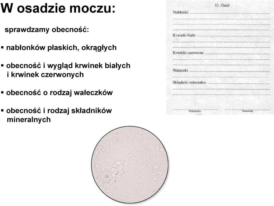 białych i krwinek czerwonych obecność o rodzaj