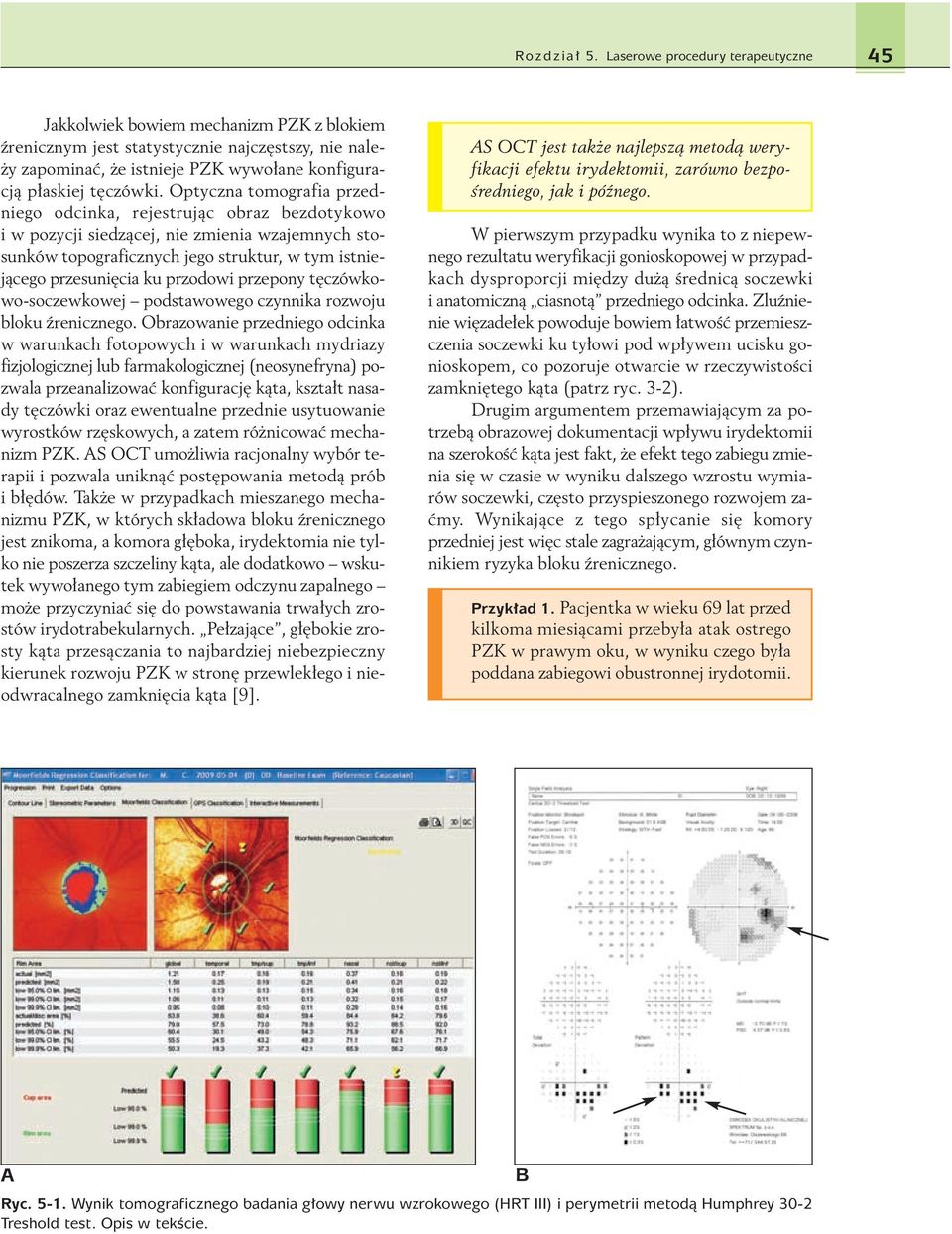 Optyczna tomografia przedniego odcinka, rejestrujàc obraz bezdotykowo i w pozycji siedzàcej, nie zmienia wzajemnych stosunków topograficznych jego struktur, w tym istniejàcego przesuni cia ku