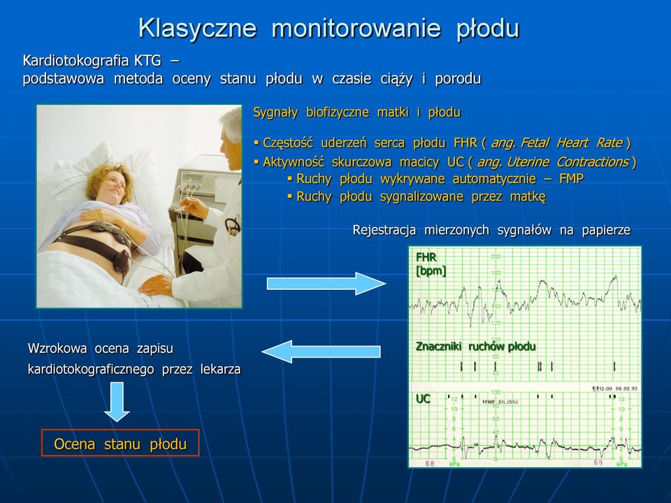 Uterine Contractions ) Ruchy płodu wykrywane automatycznie FMP Ruchy płodu sygnalizowane przez matkę Rejestracja mierzonych