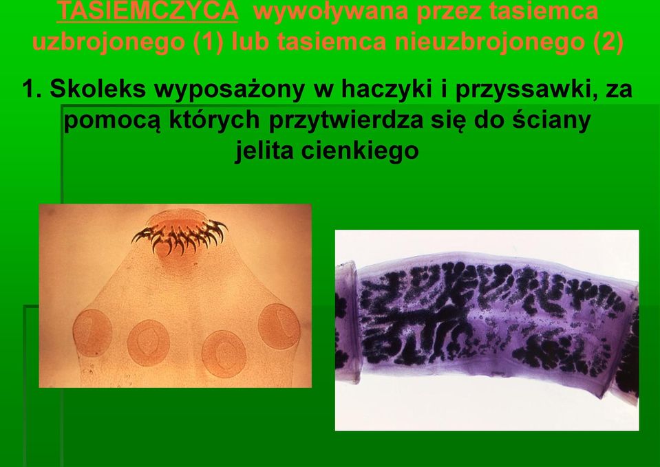 1. Skoleks wyposażony w haczyki i przyssawki, za