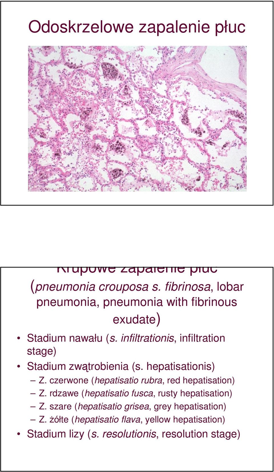 infiltrationis, infiltration stage) Stadium zwątrobienia (s. hepatisationis) Z.