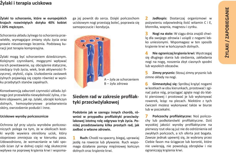 Żylaki mogą być schorzeniem dziedzicznym. Kolejnymi czynnikami, mogącymi wpływać na ich powstawanie, są: obciążenie statyczne, siedzący tryb życia, wiek, brak aktywności fizycznej, otyłość, ciąża.