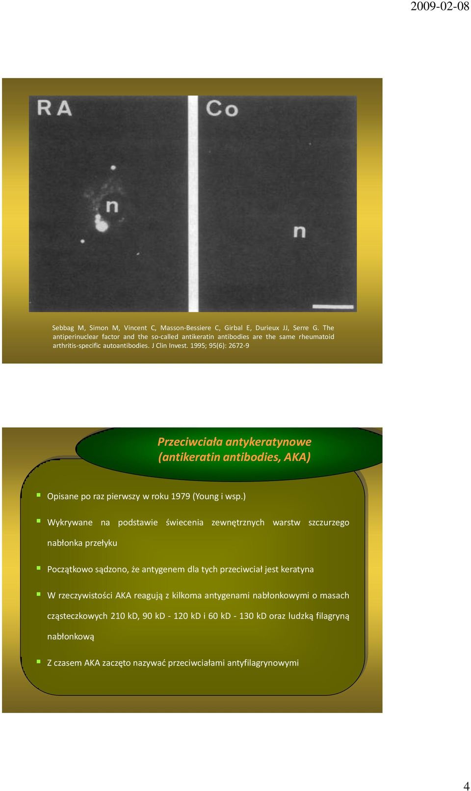 1995; 95(6): 2672-9 Przeciwciała antykeratynowe (antikeratin antibodies, AKA) Opisane po raz pierwszy w roku 1979 (Young i wsp.