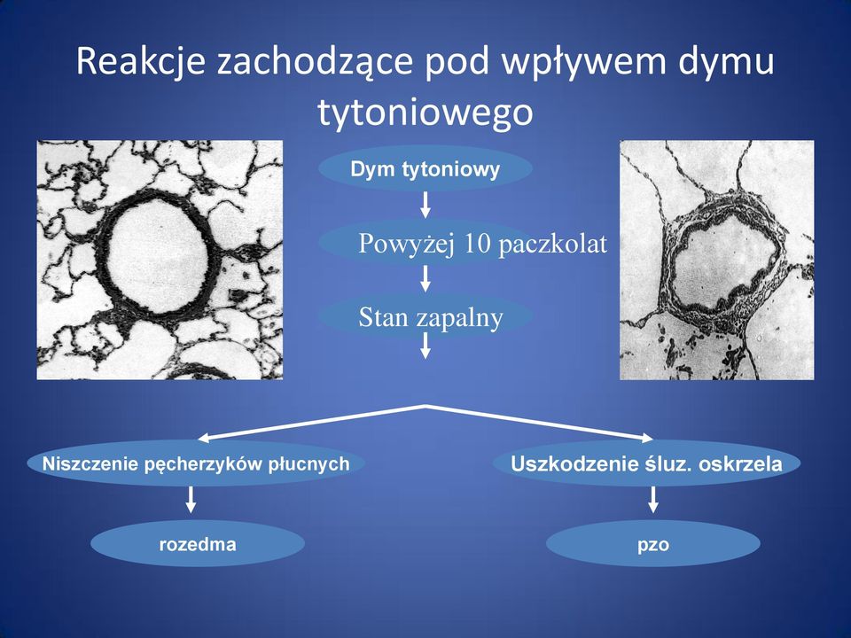 paczkolat Stan zapalny Niszczenie