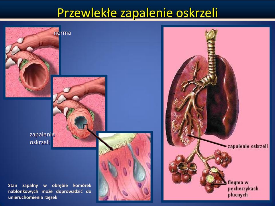 obrębie komórek nabłonkowych może