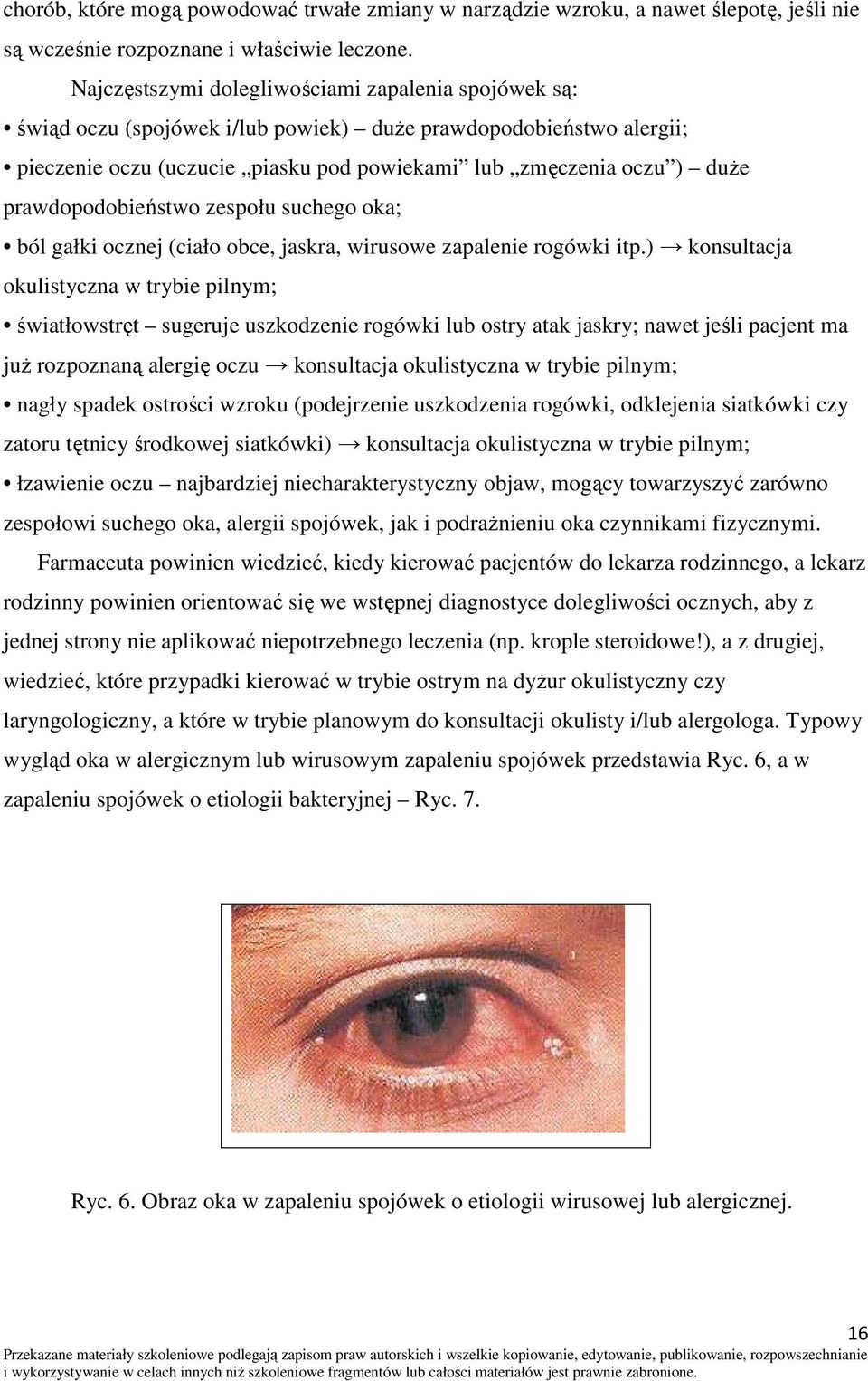 prawdopodobieństwo zespołu suchego oka; ból gałki ocznej (ciało obce, jaskra, wirusowe zapalenie rogówki itp.