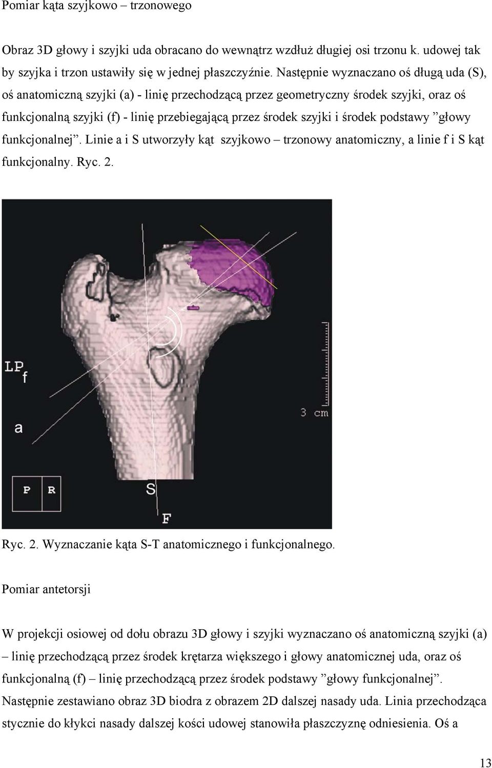 środek podstawy głowy funkcjonalnej. Linie a i S utworzyły kąt szyjkowo trzonowy anatomiczny, a linie f i S kąt funkcjonalny. Ryc. 2. Ryc. 2. Wyznaczanie kąta S-T anatomicznego i funkcjonalnego.