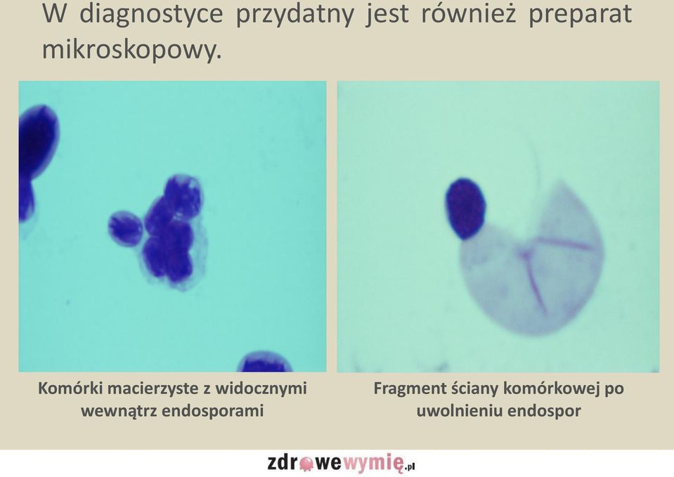 Komórki macierzyste z widocznymi