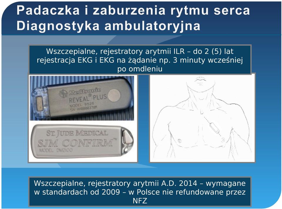 3 minuty wcześniej po omdleniu Wszczepialne, rejestratory