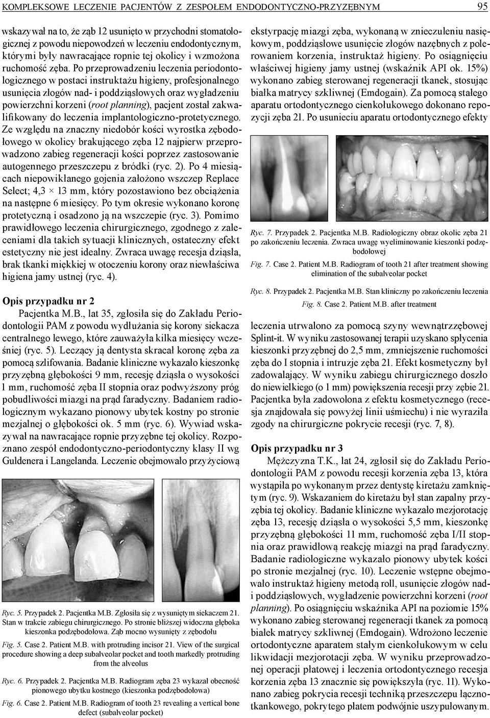 Po przeprowadzeniu leczenia periodontologicznego w postaci instruktażu higieny, profesjonalnego usunięcia złogów nad i poddziąsłowych oraz wygładzeniu powierzchni korzeni (root planning), pacjent