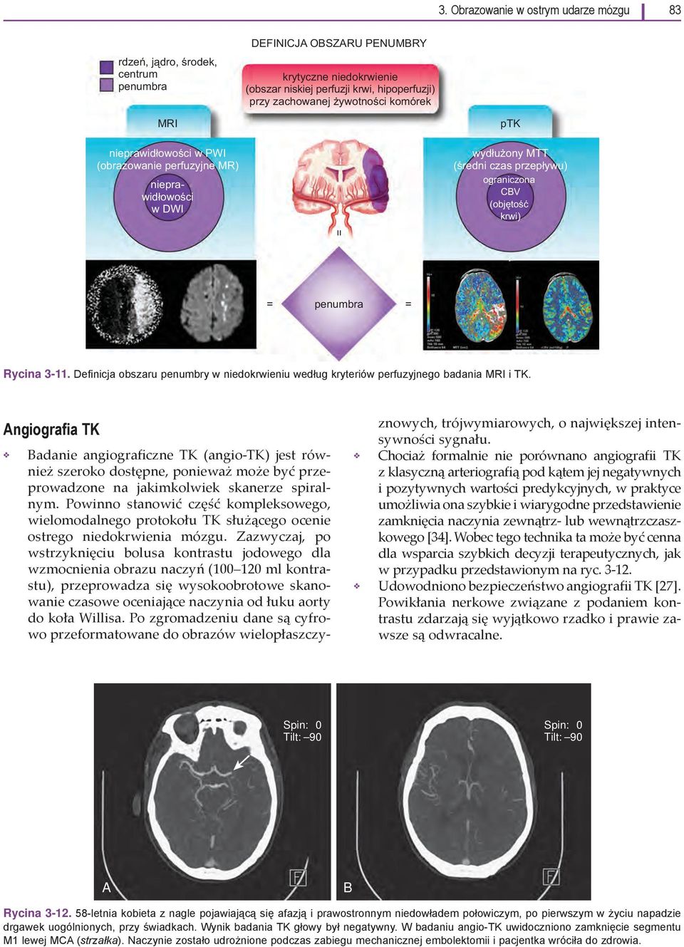 Definicja obszaru penumbry w niedokrwieniu według kryteriów perfuzyjnego badania MRI i TK.