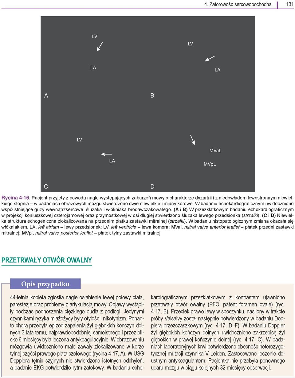 korowe. W badaniu echokardiograficznym uwidoczniono współistniejące guzy wewnątrzsercowe: śluzaka i włókniaka brodawczakowatego.
