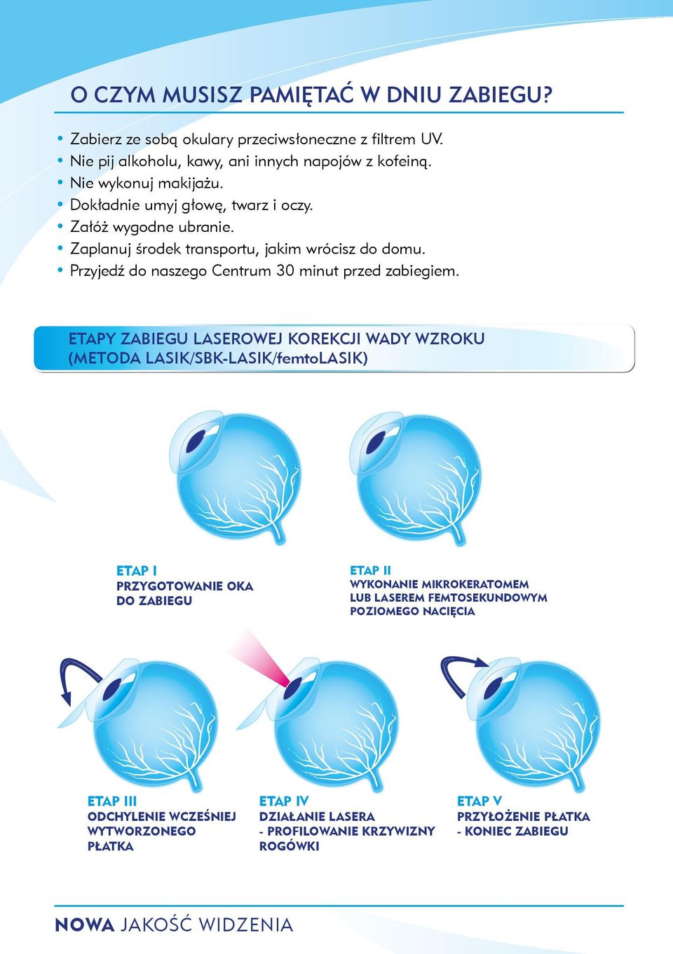 ETAPY ZABIEGU LASEROWEJ KOREKCJI WADY WZROKU (METODA LASIK/SBK-LASIK/femtoLASIK) ETAP I PRZYGOTOWANIE OKA DO ZABIEGU ETAP II WYKONANIE MIKROKERATOMEM lub laserem