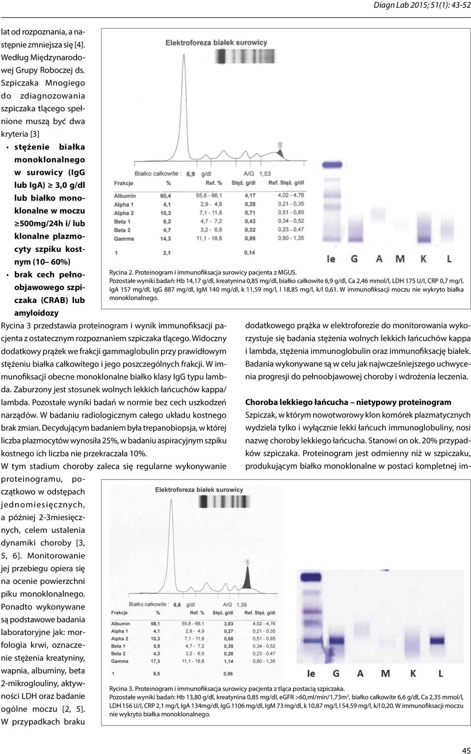 i/ lub klonalne plazmocyty szpiku kostnym (10 60%) brak cech pełnoobjawowego szpiczaka (CRAB) lub amyloidozy Rycina 3 przedstawia proteinogram i wynik immunofiksacji pacjenta z ostatecznym