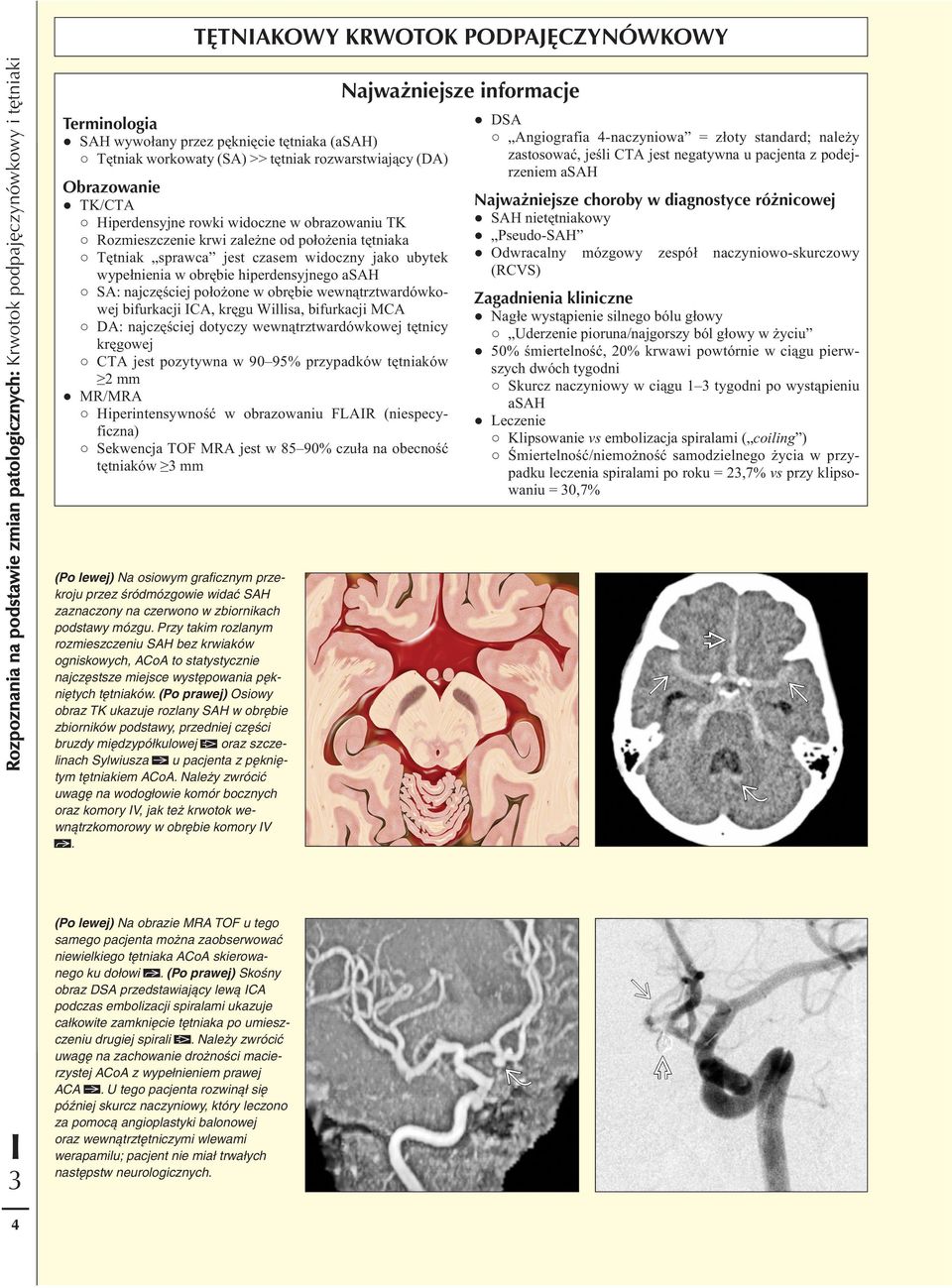 wewnątrztwardówkowej bifurkacji CA, kręgu Willisa, bifurkacji MCA DA: najczęściej dotyczy wewnątrztwardówkowej tętnicy kręgowej CTA jest pozytywna w 90 95% przypadków tętniaków 2 mm MR/MRA