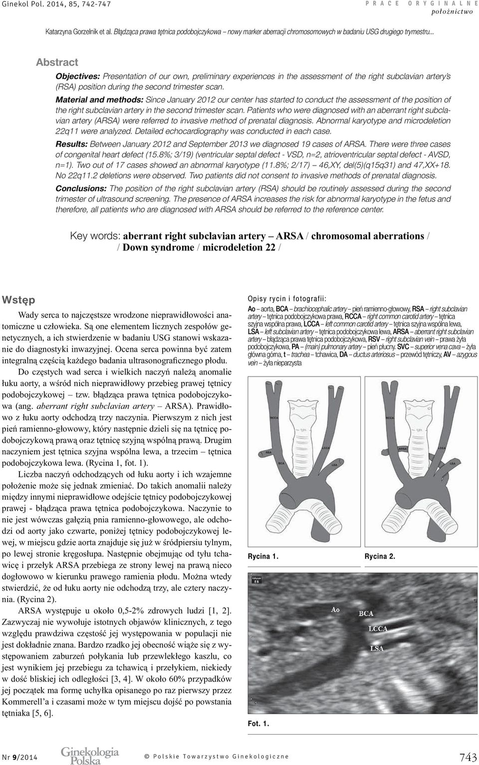 Patients who were diagnosed with an aberrant right subclavian artery (ARSA) were referred to invasive method of prenatal diagnosis. Abnormal karyotype and microdeletion 22q11 were analyzed.