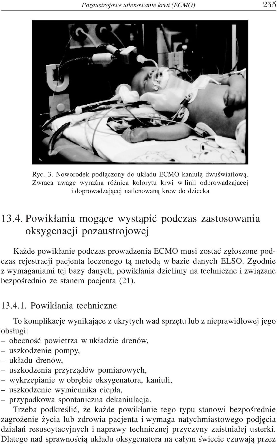 Powikłania mogące wystąpić podczas zastosowania oksygenacji pozaustrojowej Każde powikłanie podczas prowadzenia ECMO musi zostać zgłoszone pod czas rejestracji pacjenta leczonego tą metodą w bazie