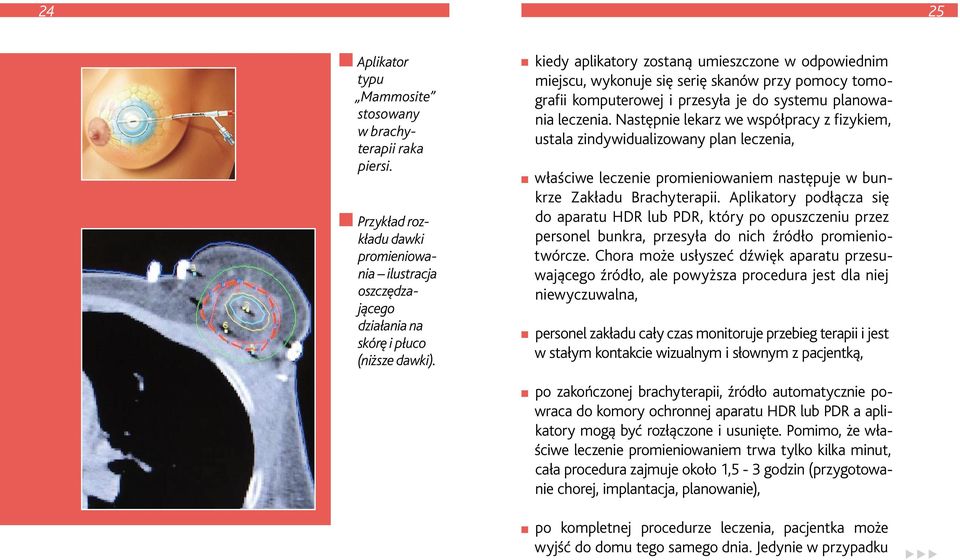Następnie lekarz we współpracy z fizykiem, ustala zindywidualizowany plan leczenia, właściwe leczenie promieniowaniem następuje w bunkrze Zakładu Brachyterapii.