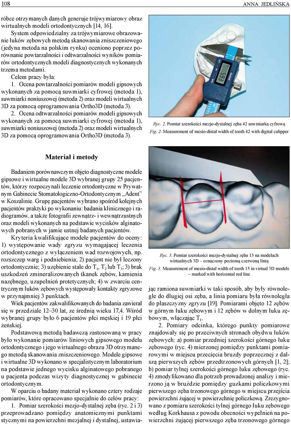 wyników pomiarów ortodontycznych modeli diagnostycznych wykonanych trzema metodami. Celem pracy była: 1.