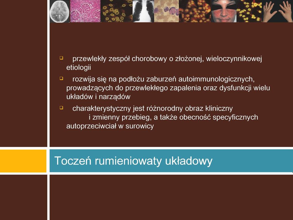 układów i narządów charakterystyczny jest różnorodny obraz kliniczny i zmienny przebieg, a