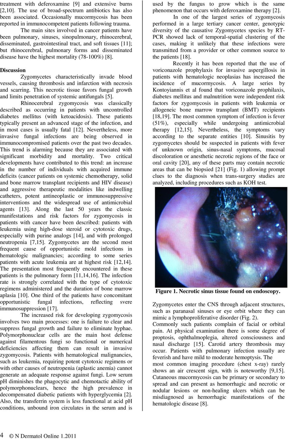 The main sites involved in cancer patients have been pulmonary, sinuses, sinopulmonary, rhinocerebral, disseminated, gastrointestinal tract, and soft tissues [11]; but rhinocerebral, pulmonary forms