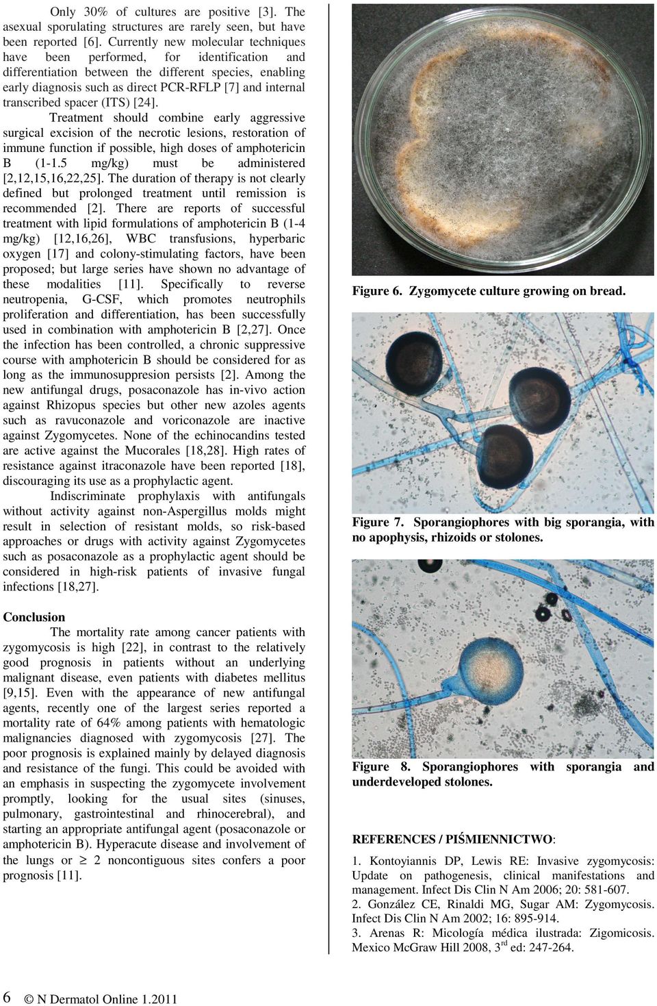 transcribed spacer (ITS) [24]. Treatment should combine early aggressive surgical excision of the necrotic lesions, restoration of immune function if possible, high doses of amphotericin B (1-1.