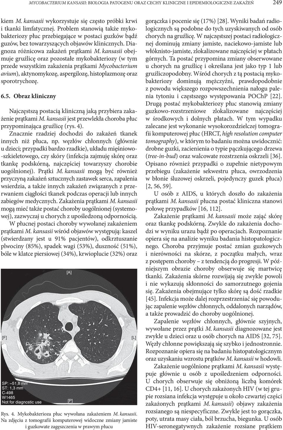 kansasii obejmuje gruźlicę oraz pozostałe mykobakteriozy (w tym przede wszystkim zakażenia prątkami Mycobacterium avium), aktynomykozę, aspergilozę, histoplazmozę oraz sporotrychozę. 6.5.