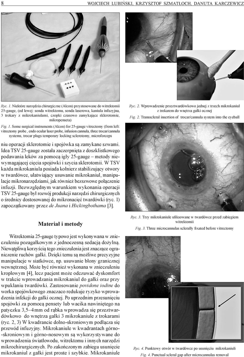 sklerotomie, mikropenseta) Fig. 1.