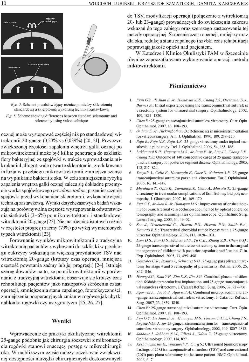 W Katedrze i Klinice Okulistyki PAM w Szczecinie również zapoczątkowano wykonywanie operacji metodą mikrowitrektomii. Piśmiennictwo Ryc. 5.