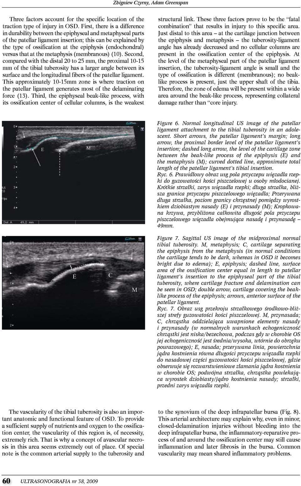 (endochondral) versus that at the metaphysis (membranous) (10).