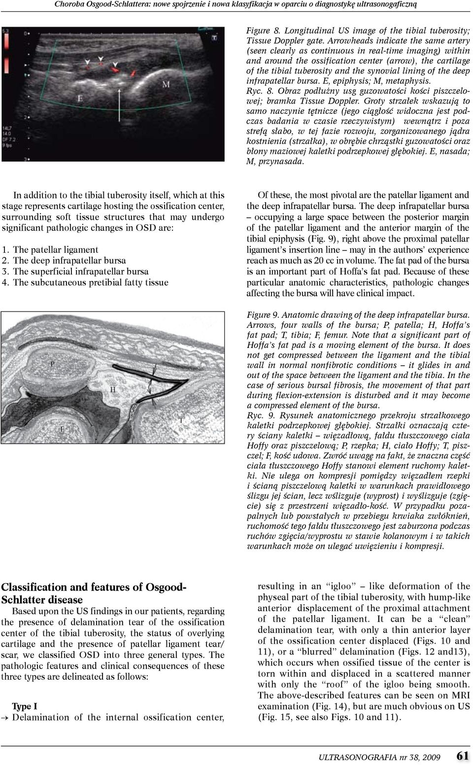 of the deep infrapatellar bursa. E, epiphysis; M, metaphysis. Ryc. 8. Obraz podłużny usg guzowatości kości piszczelowej; bramka Tissue Doppler.