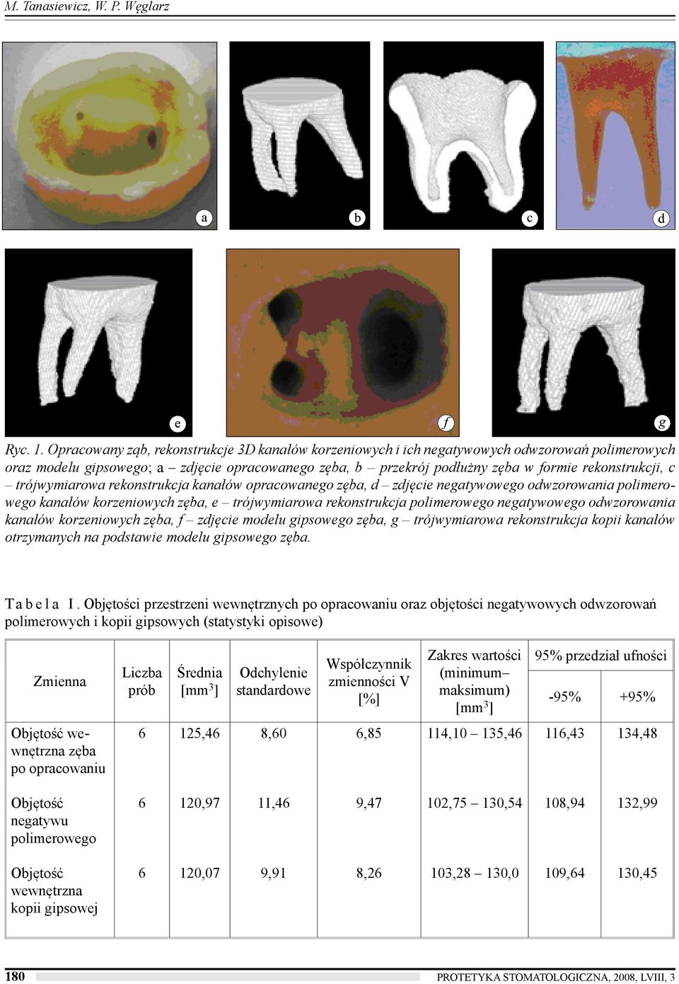 trójwymiarowa rekonstrukcja kanałów opracowanego zęba, d zdjęcie negatywowego odwzorowania polimerowego kanałów korzeniowych zęba, e trójwymiarowa rekonstrukcja polimerowego negatywowego odwzorowania