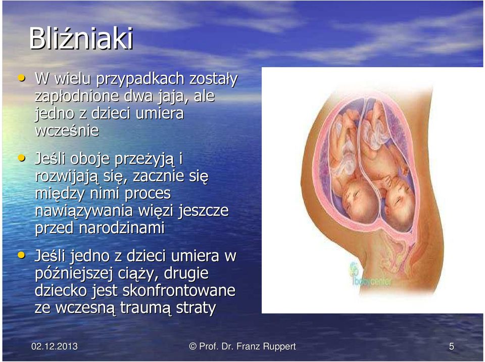 nawiązywania więzi jeszcze przed narodzinami Jeśli jedno z dzieci umiera w późniejszej