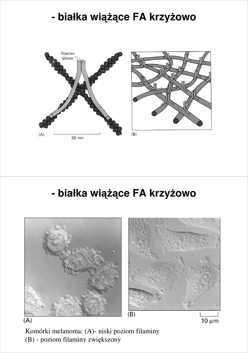 Komórki melanoma: (A)- niski