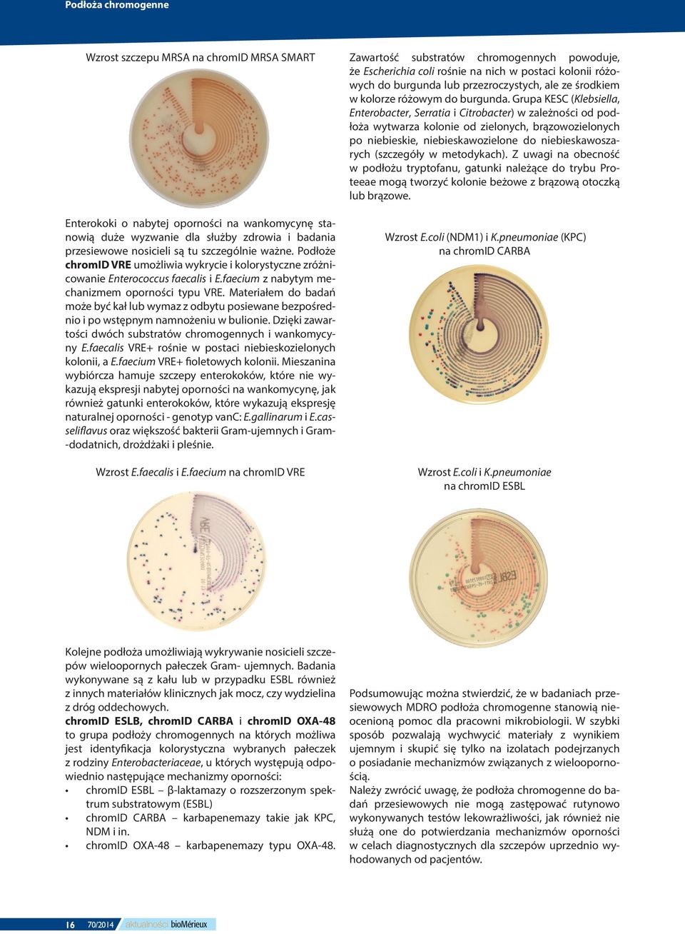 Materiałem do badań może być kał lub wymaz z odbytu posiewane bezpośrednio i po wstępnym namnożeniu w bulionie. Dzięki zawartości dwóch substratów chromogennych i wankomycyny E.