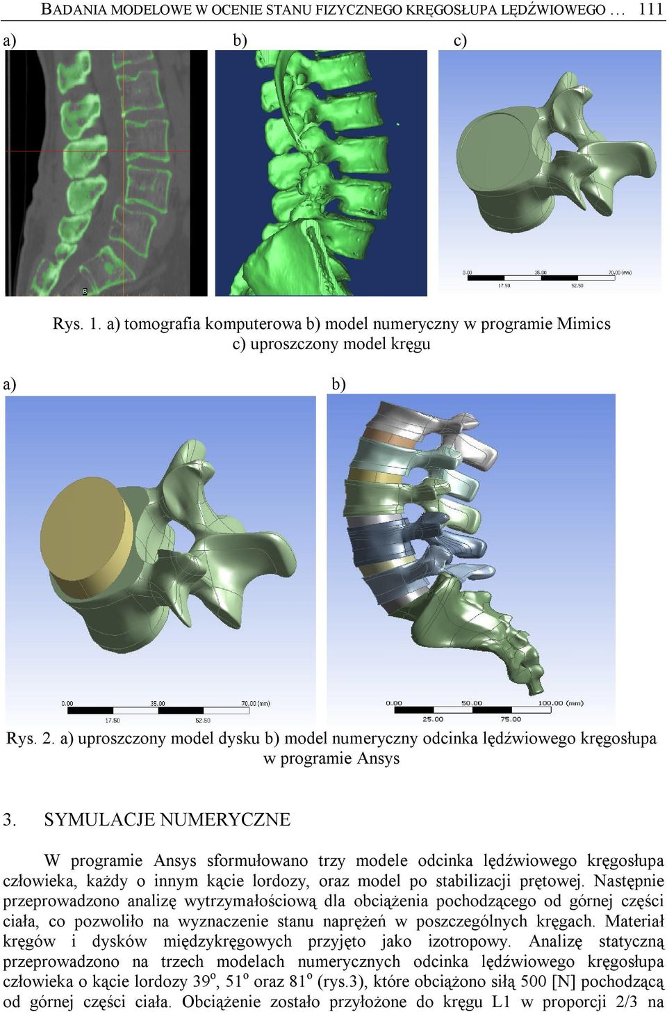 SYMULACJE NUMERYCZNE W programie Ansys sformułowano trzy modele odcinka lędźwiowego kręgosłupa człowieka, każdy o innym kącie lordozy, oraz model po stabilizacji prętowej.