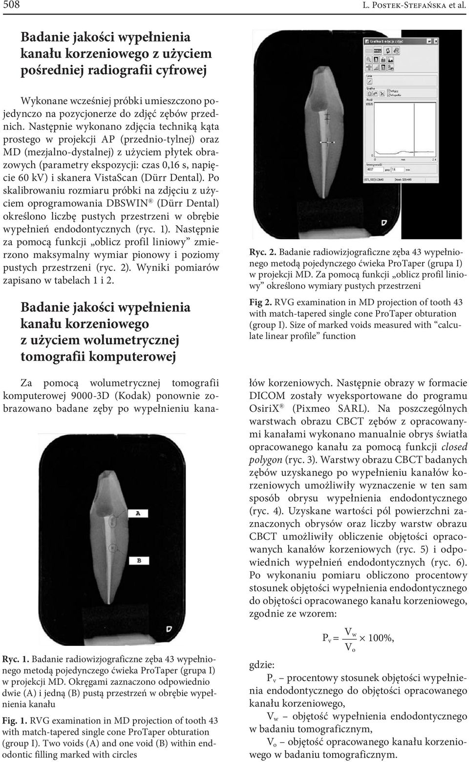 Następnie wykonano zdjęcia techniką kąta prostego w projekcji AP (przednio-tylnej) oraz MD (mezjalno-dystalnej) z użyciem płytek obrazowych (parametry ekspozycji: czas 0,16 s, napięcie 60 kv) i