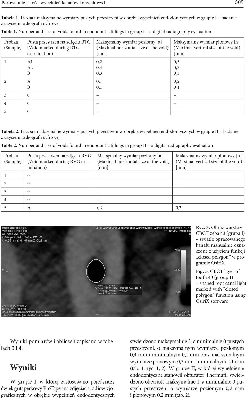 Number and size of voids found in endodontic fillings in group I a digital radiography evaluation Próbka (Sample) 1 A1 A2 B 2 A B Pusta przestrzeń na zdjęciu RTG (Void marked during RTG examination)