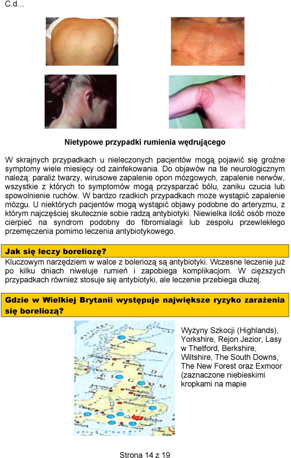 ruchów. W bardzo rzadkich przypadkach może wystąpić zapalenie mózgu. U niektórych pacjentów mogą wystąpić objawy podobne do arteryzmu, z którym najczęściej skutecznie sobie radzą antybiotyki.