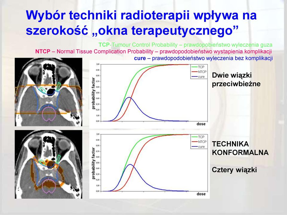 Complication Probability prawdopodobieństwo wystapienia komplikacji cure