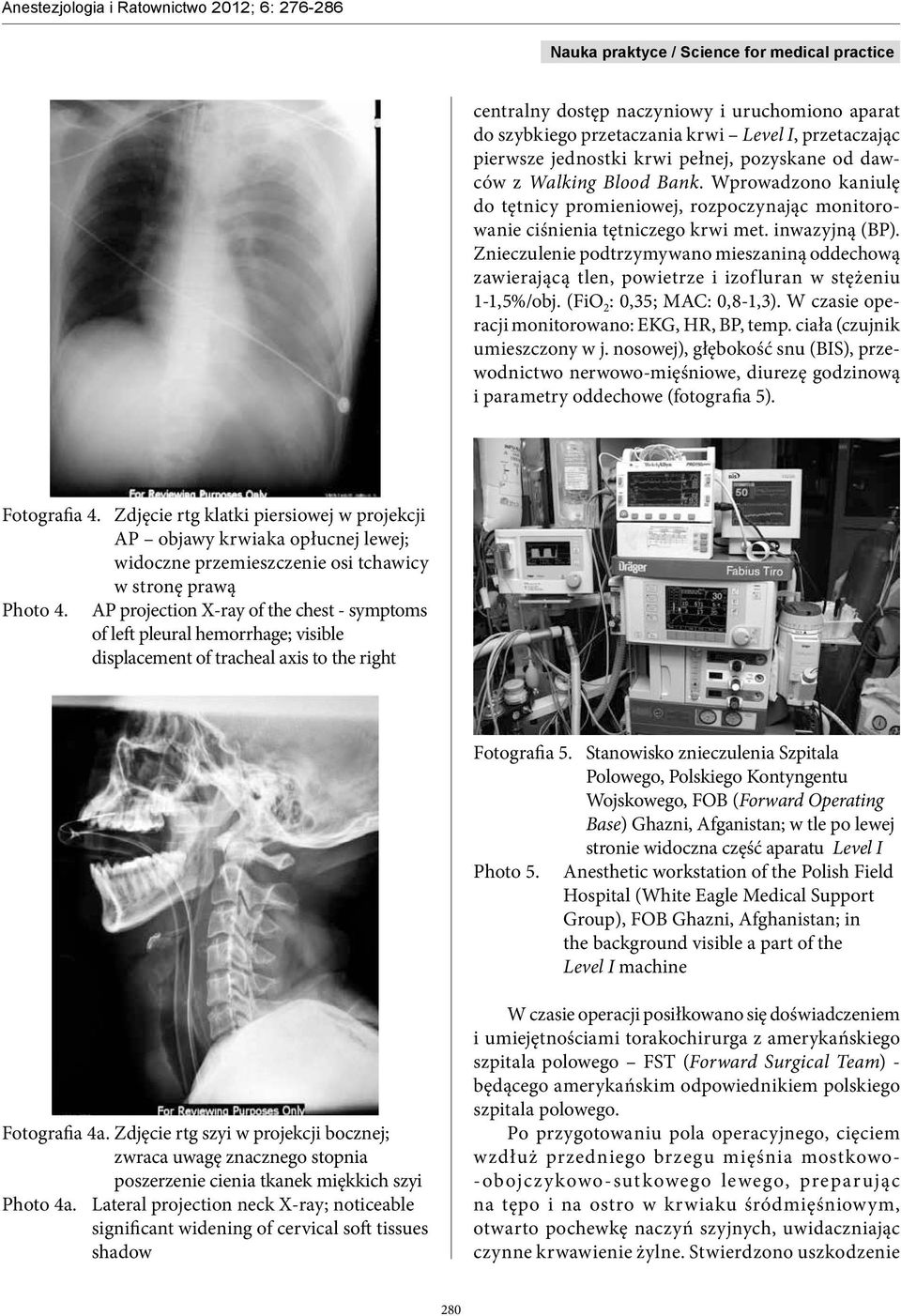 Znieczulenie podtrzymywano mieszaniną oddechową zawierającą tlen, powietrze i izofluran w stężeniu 1-1,5%/obj. (FiO 2 : 0,35; MAC: 0,8-1,3). W czasie operacji monitorowano: EKG, HR, BP, temp.