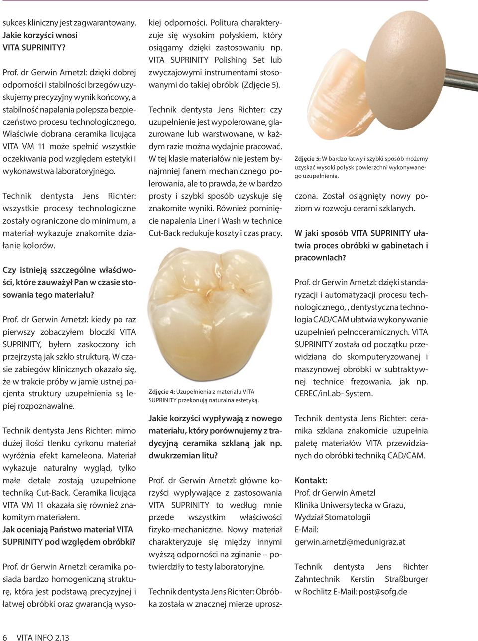 Właściwie dobrana ceramika licująca VITA VM 11 może spełnić wszystkie oczekiwania pod względem estetyki i wykonawstwa laboratoryjnego.