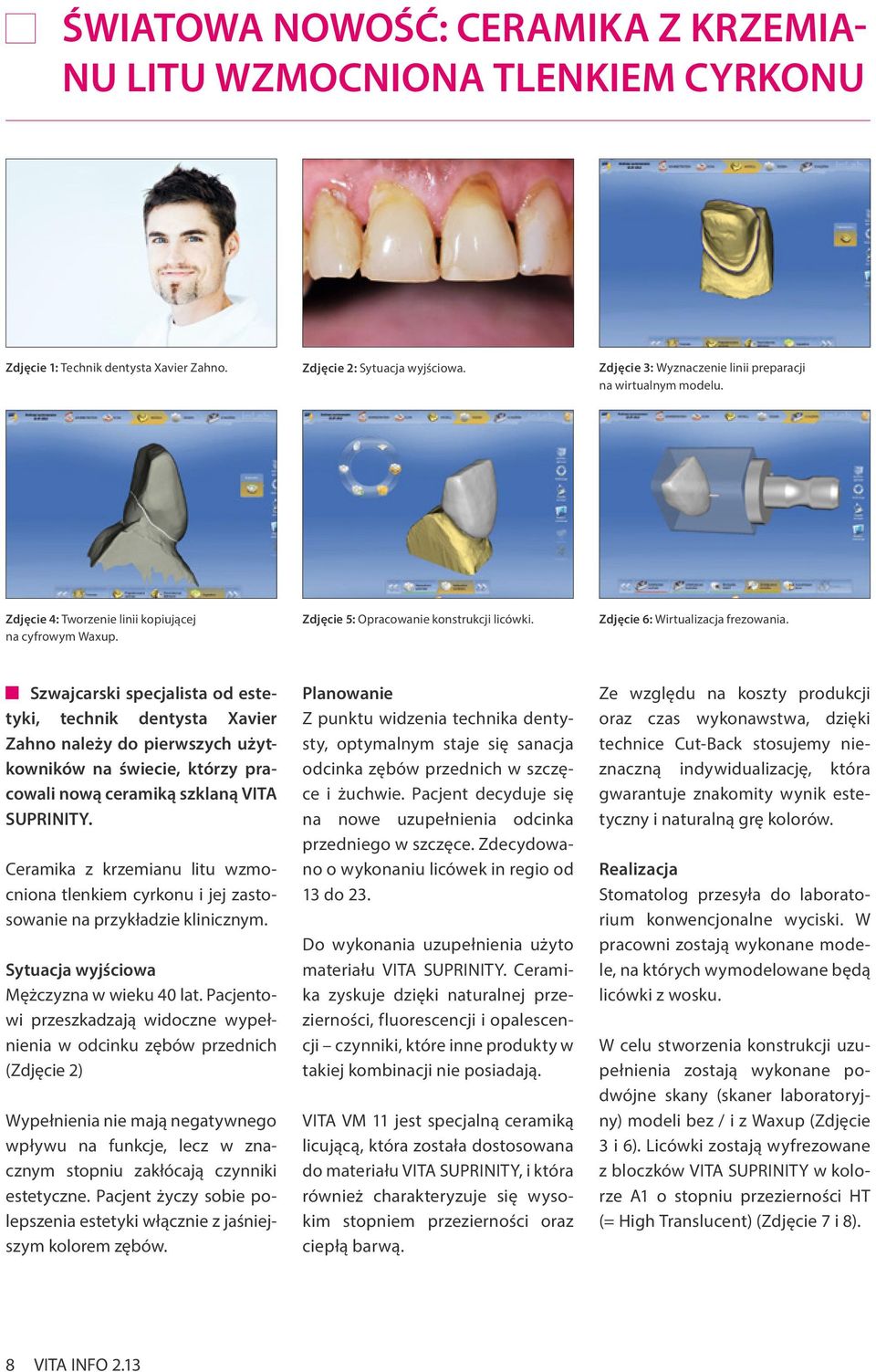 Szwajcarski specjalista od estetyki, technik dentysta Xavier Zahno należy do pierwszych użytkowników na świecie, którzy pracowali nową ceramiką szklaną VITA SUPRINITY.