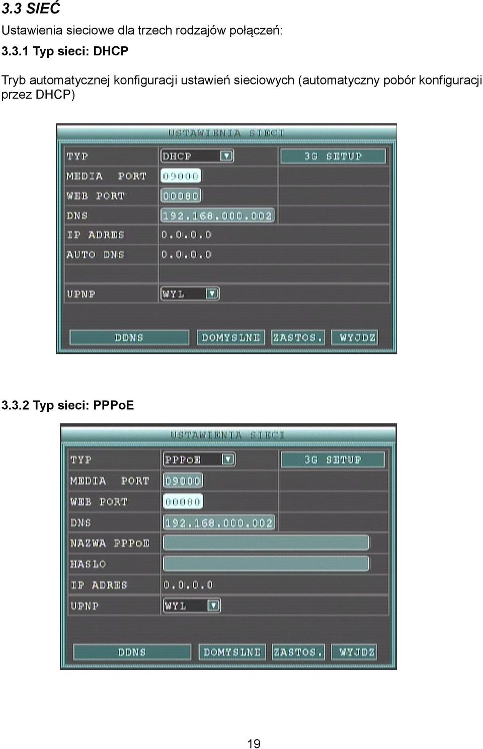 3.1 Typ sieci: DHCP Tryb automatycznej