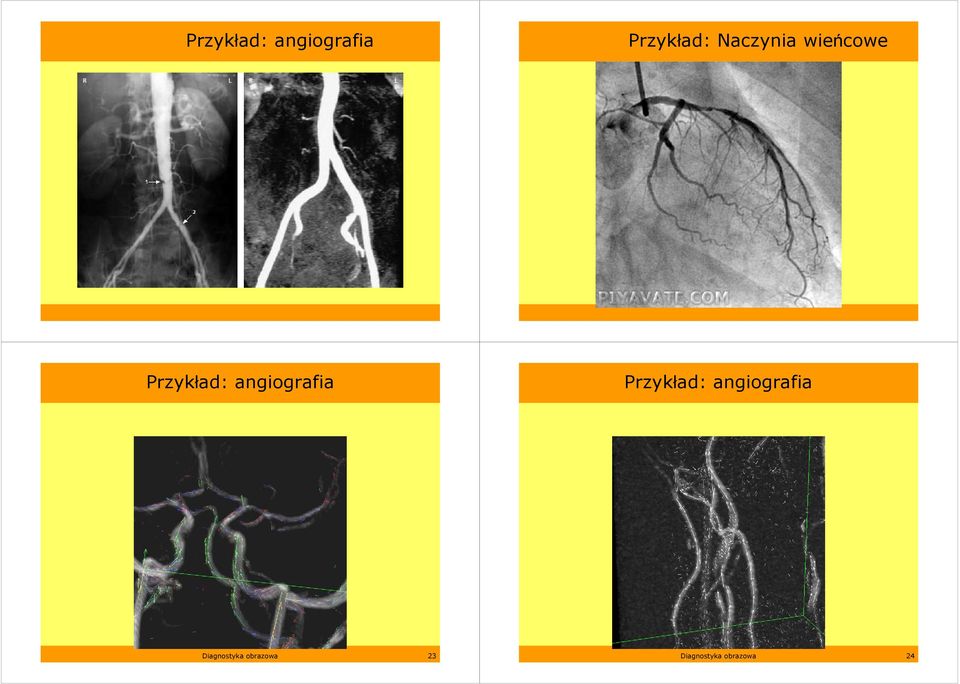 Diagnostyka obrazowa 23 Diagnostyka