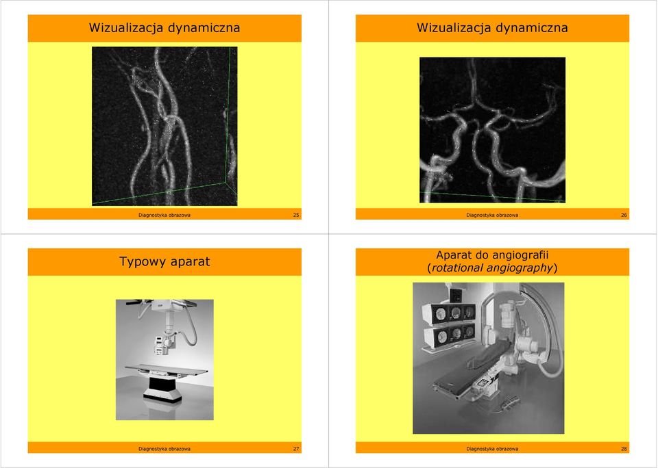 Typowy aparat Aparat do angiografii (rotational