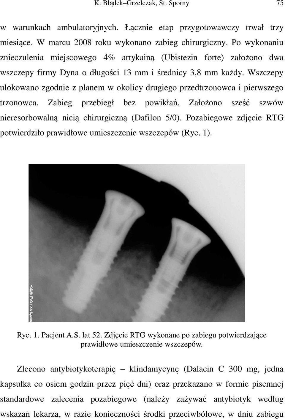 Wszczepy ulokowano zgodnie z planem w okolicy drugiego przedtrzonowca i pierwszego trzonowca. Zabieg przebiegł bez powikłań. Założono sześć szwów nieresorbowalną nicią chirurgiczną (Dafilon 5/0).