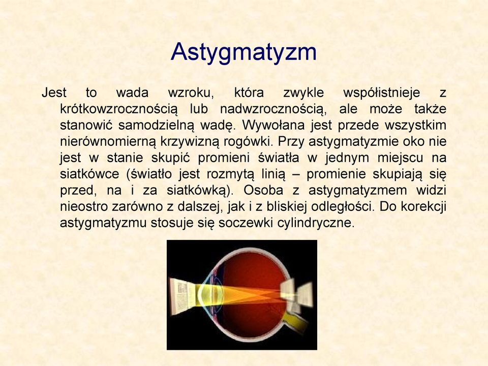 Przy astygmatyzmie oko nie jest w stanie skupić promieni światła w jednym miejscu na siatkówce (światło jest rozmytą linią