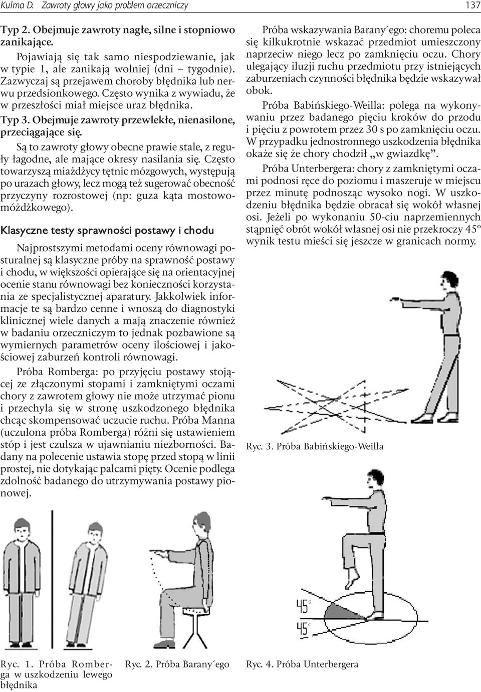 Często wynika z wywiadu, że w przeszłości miał miejsce uraz błędnika. Typ 3. Obejmuje zawroty przewlekłe, nienasilone, przeciągające się.